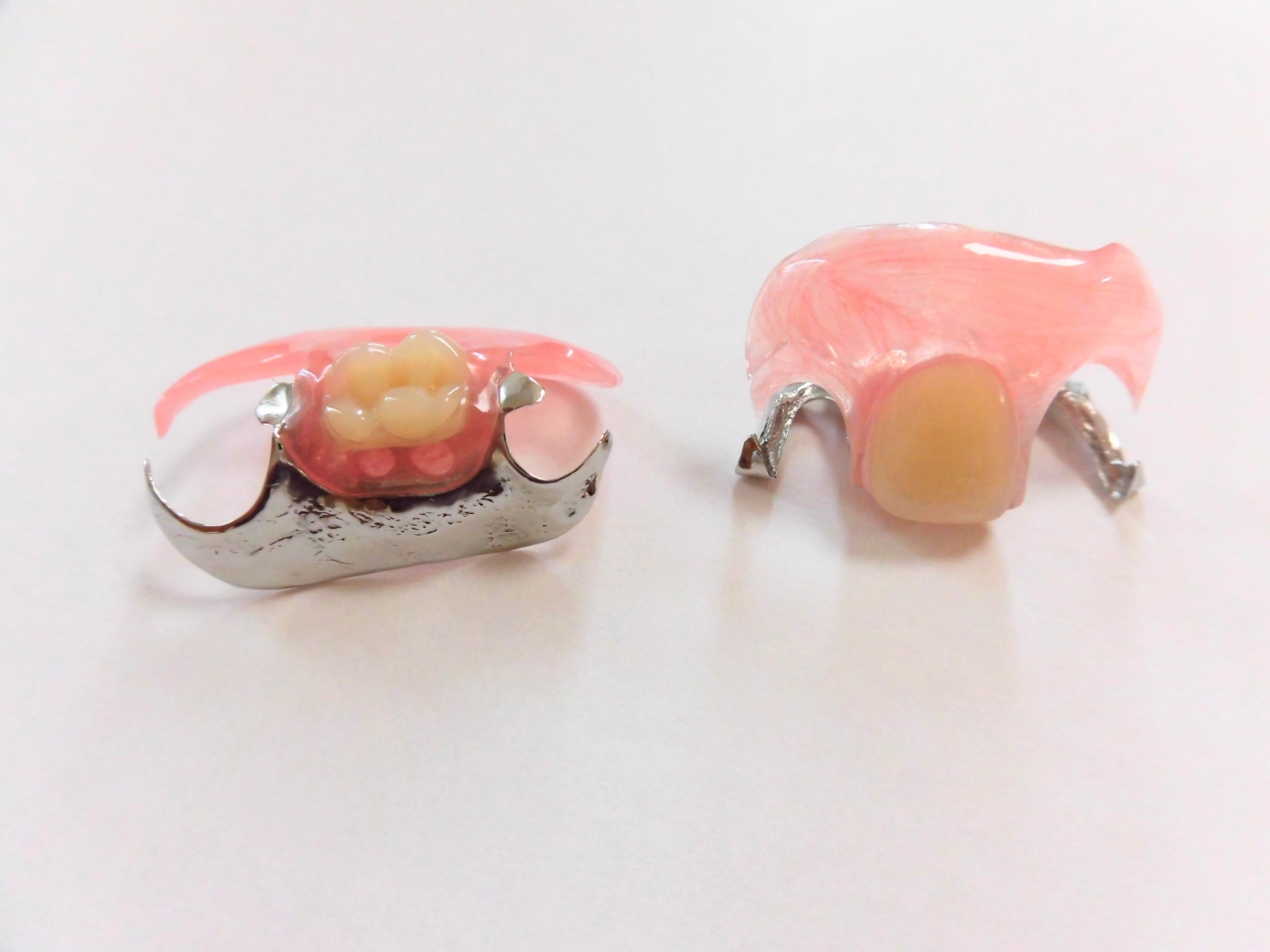 コバルトクロム床＋ノンクラスプ義歯