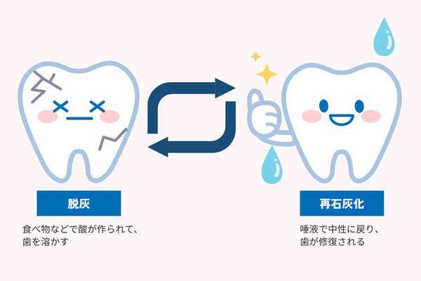 脱灰と再石灰化